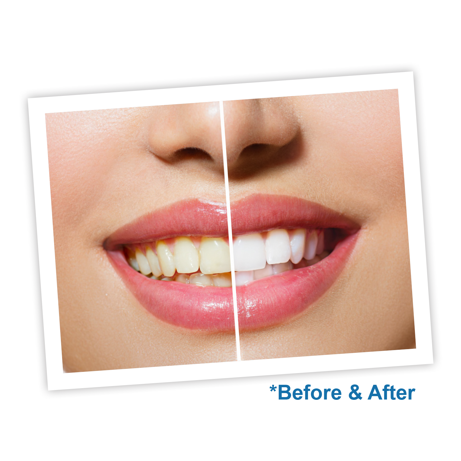 White Teeth Photo Editor change comin